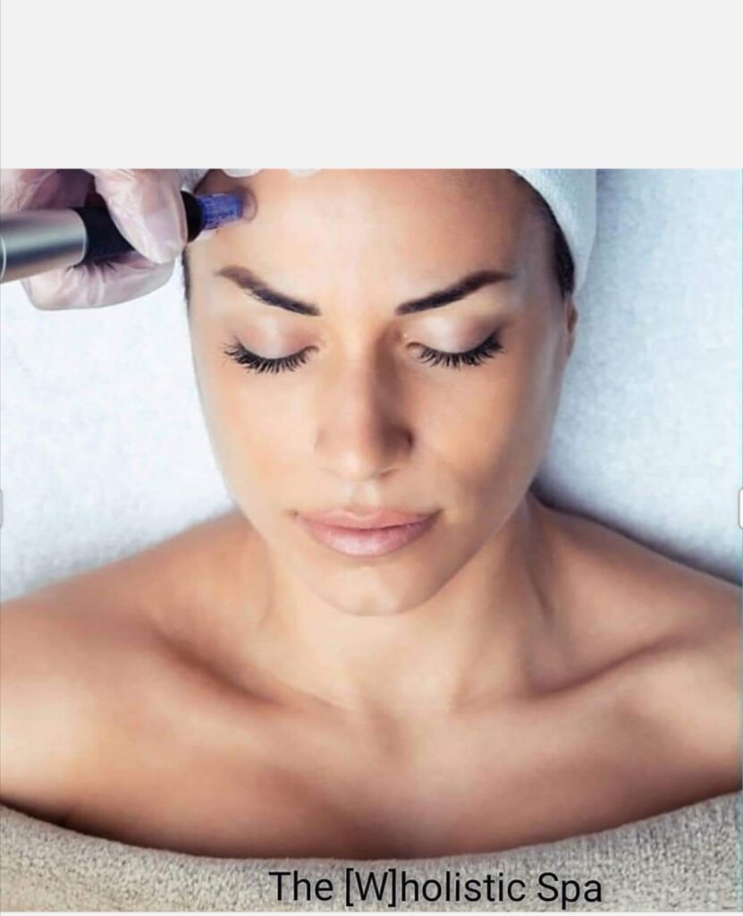 Micro-Needling Treatments - The [W]holistic Co. Aesthetics Studio