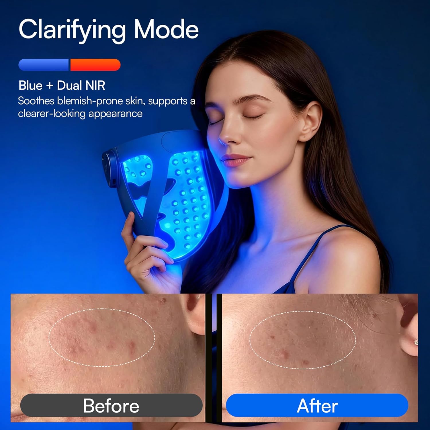 INIA Glow 4D Wireless Red Light Therapy Mask for face - Image 4