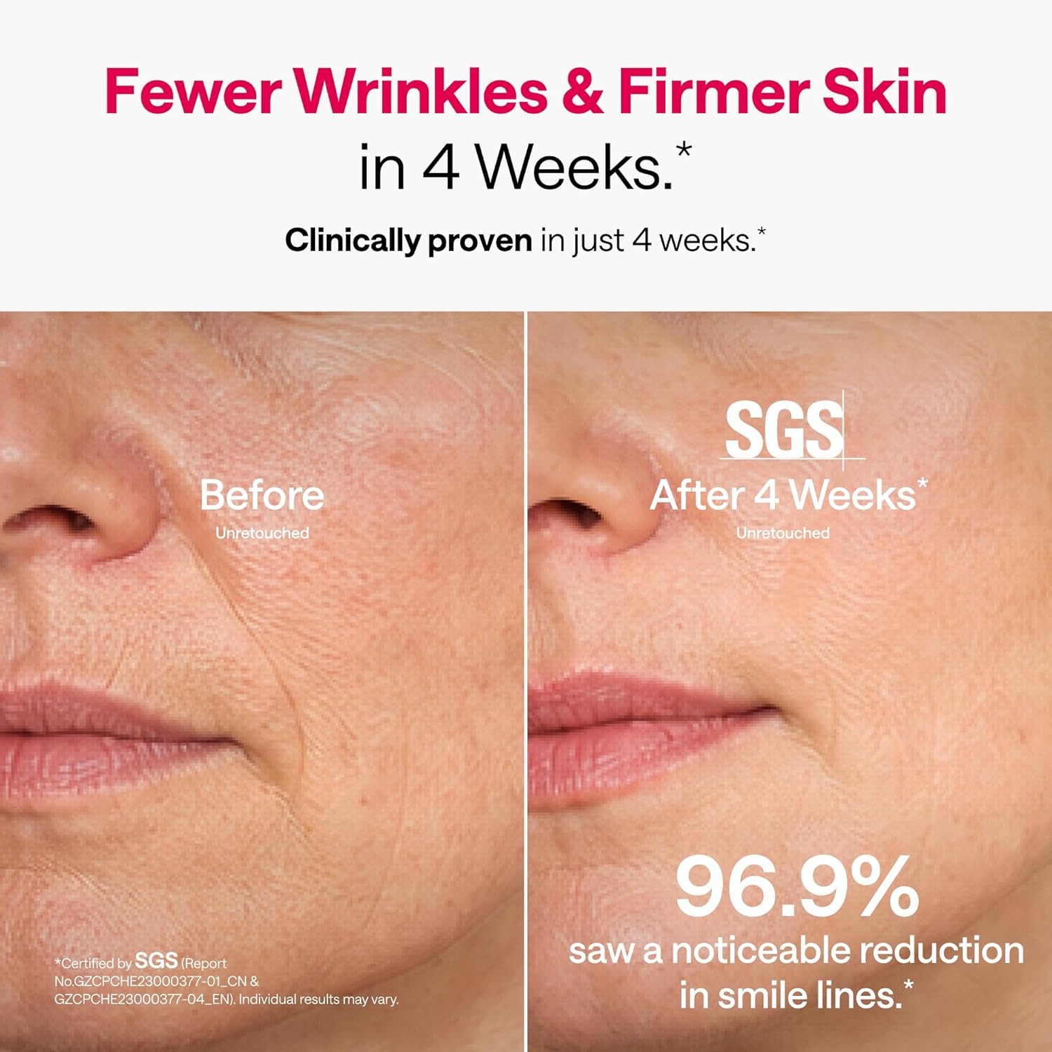 Ulike Reglow LED Light Therapy Face Mask - Image 8